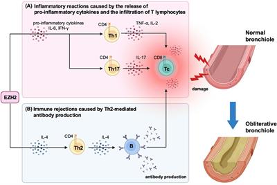 Assessment of the Therapeutic Potential of Enhancer of Zeste Homolog 2 Inhibition in a Murine Model of Bronchiolitis Obliterans Syndrome